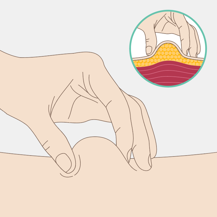 Pinch skin